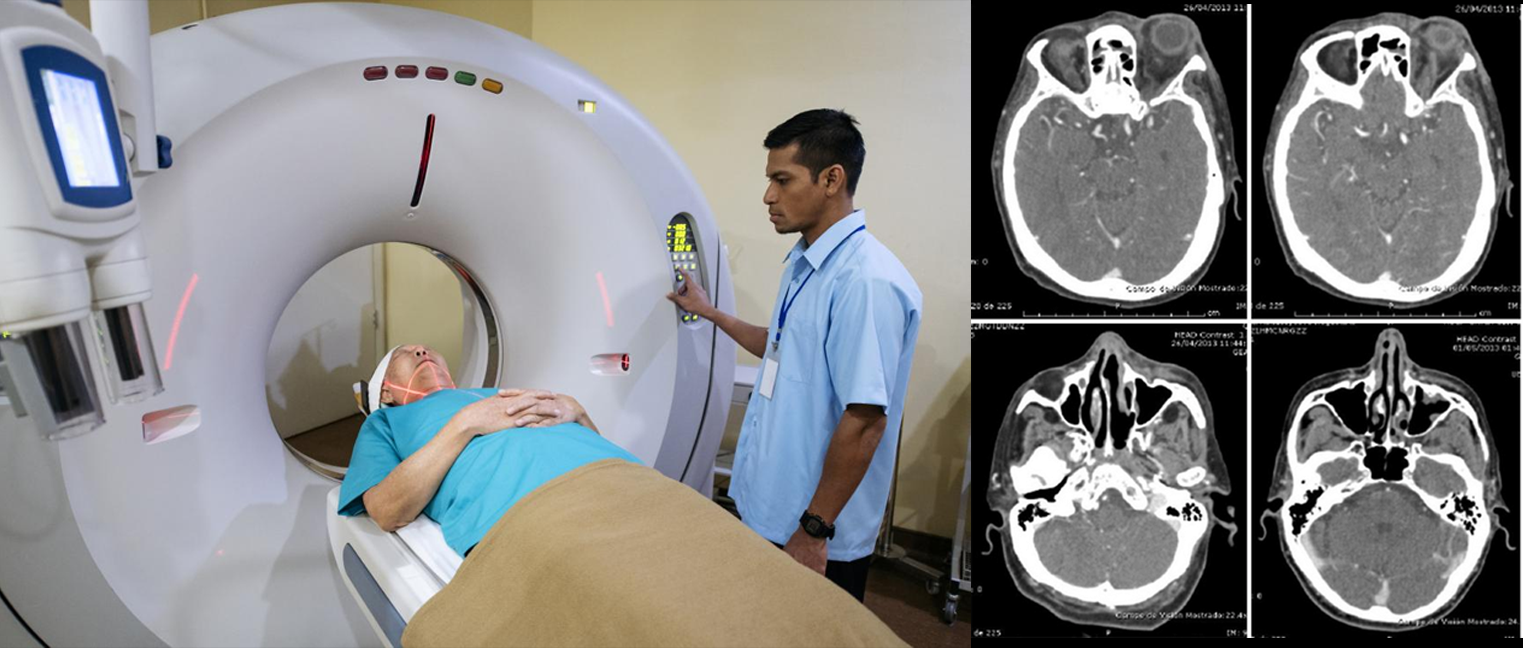 CAT Scan
